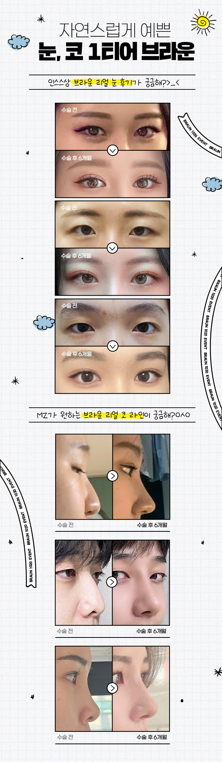 브라운성형외과 새학기 이벤트 ♡ 예쁘게 학교 다녀오겠습니다! 관련 이미지 7