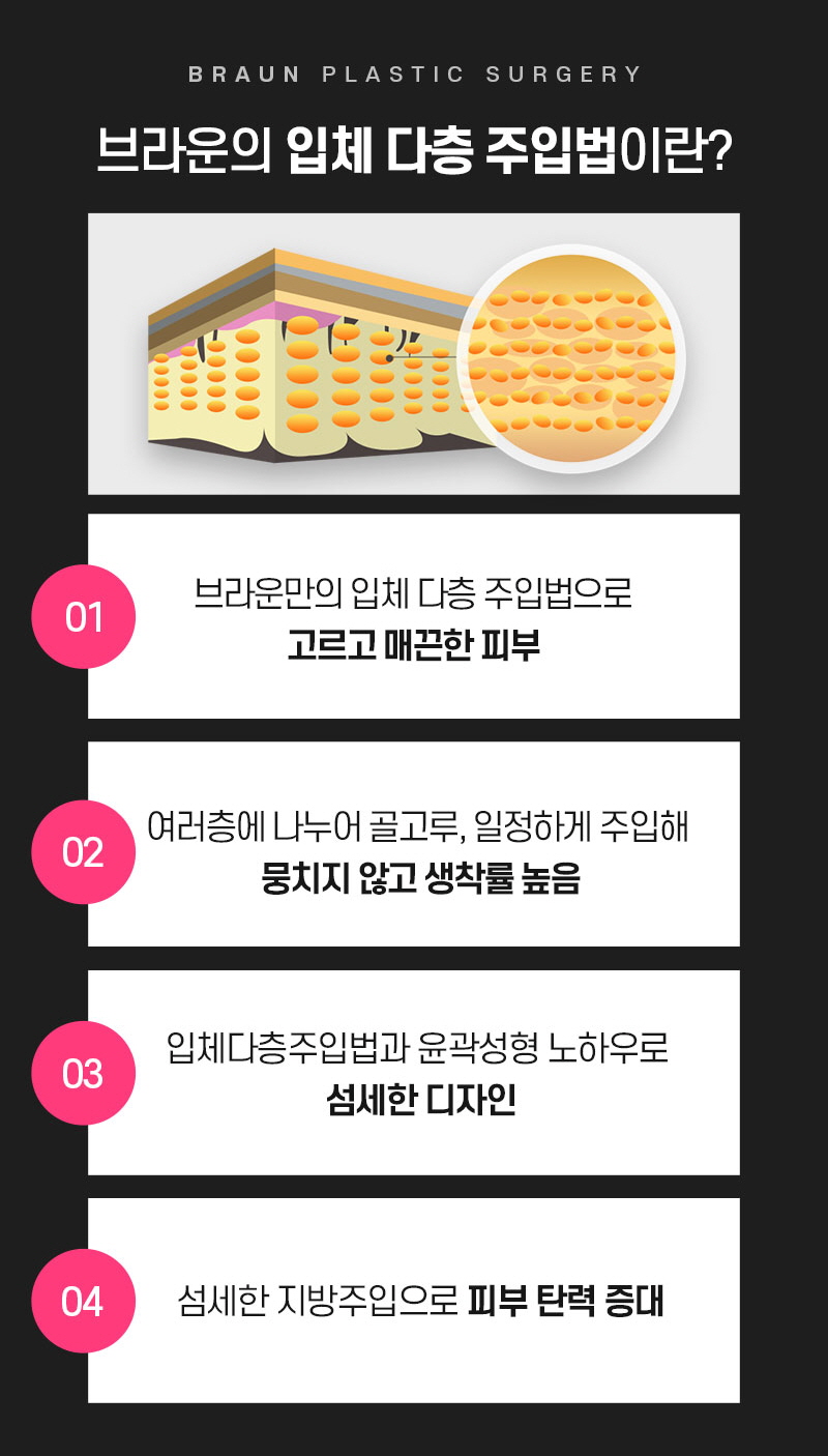 브라운성형외과 얼굴지방이식 :: 입체감 있게 예쁜 내 얼굴 관련 이미지 4