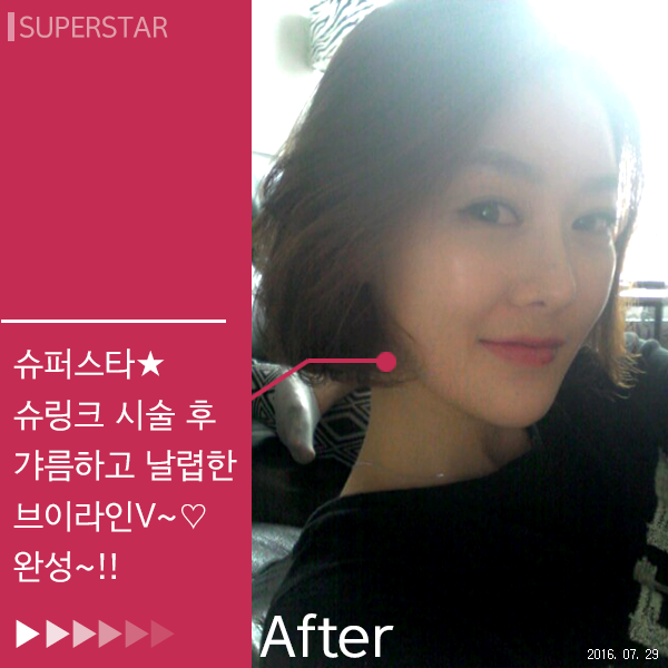 [대림피부과전문의]피부를 UPUP~차세대 초음파 리프팅 울트라포머3 슈.링.크~ 관련 이미지 3