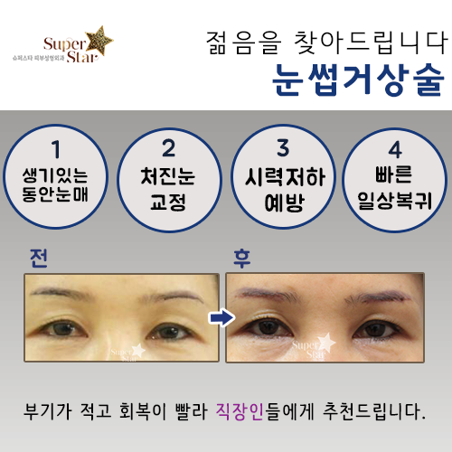 [구로눈성형]구로눈성형잘하는 슈퍼스타피부성형외과~!! 직장인들에게 추천드리는 빠른복귀눈성형 소개해드려요~ 관련 이미지 3