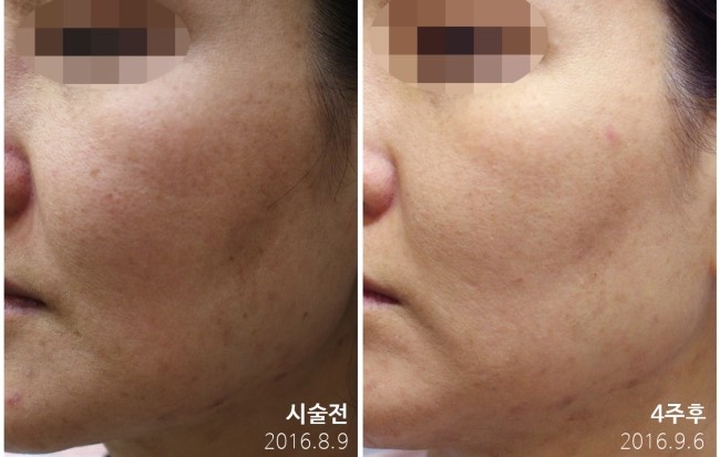 [구로색소]슈퍼스타 9,10월 가을이벤트~그대에게 미백을![듀얼토닝미백이벤트] 관련 이미지 5