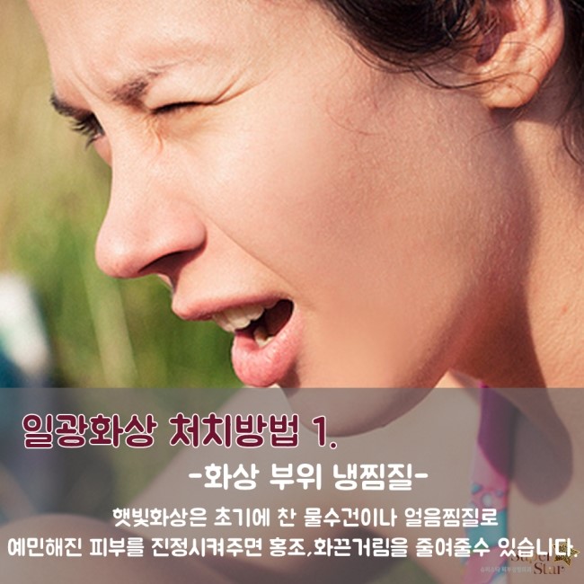 [구로피부과전문의] 슈퍼스타피부과가 알려주는 일광화상 처치방법~! 관련 이미지 3