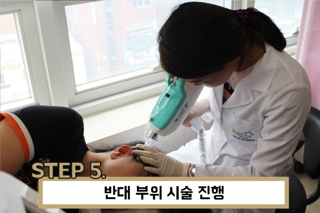 [구로리프팅]통증없는 즉각 효과! 슈퍼스타 에어젯 골드 리프팅으로 동안 외모 만들기! 관련 이미지 6