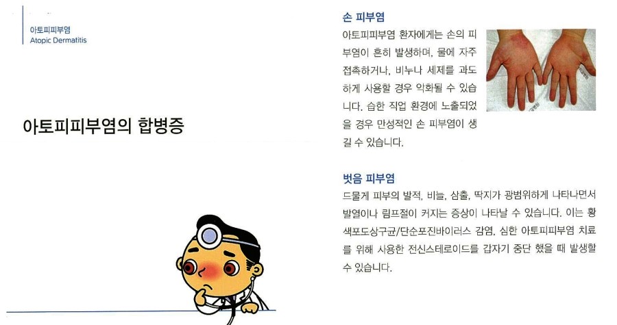 [구로피부과전문의]슈퍼스타피부과에서 알려주는 피부질환 이야기. 아토피 피부염-2 관련 이미지 6