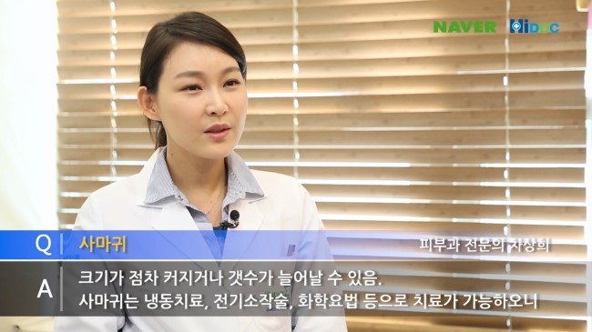 티눈, 사마귀 어떻게 치료해야 할까요? 관련 이미지 5