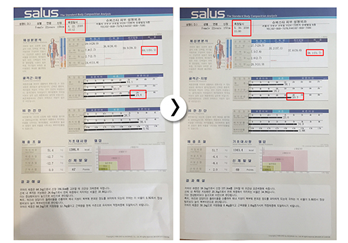 [구로비만클리닉] 슈퍼스타 5주 복부관리프로그램~ 6kg감량 성공스토리!! 관련 이미지 6