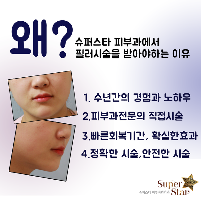 [구로피부과전문의] 전문의가 직접 시술하는 슈퍼스타 쁘띠필러! 간단하고 빠른 효과를 보고 싶으시다면 주목! 관련 이미지 2