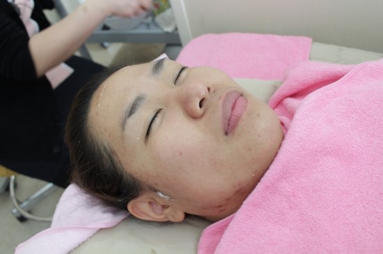[구로디지털단지피부과여드름관리] 슈퍼스타피부과 만의 봄맞이 여드름관리 ! 관련 이미지 12