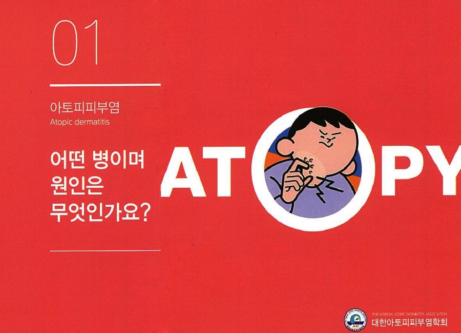 [구로피부과전문의]슈퍼스타피부과에서 알려주는 피부질환 이야기. 아토피 피부염-1 관련 이미지 2