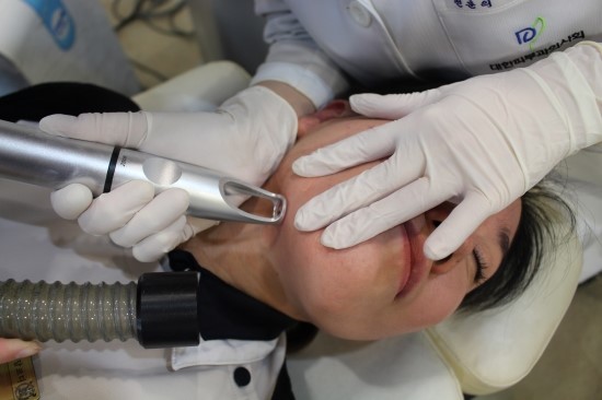 점 빼는 방법을 자세히 공개할게요~! 관련 이미지 4
