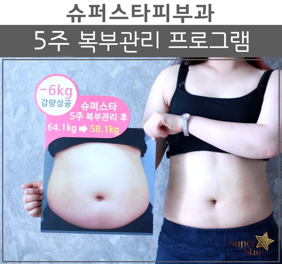 [구로비만클리닉]슈퍼스타 5주 복부관리 프로그램~마지막 시상식이 있었던 현장! 고고고~ 관련 이미지 1