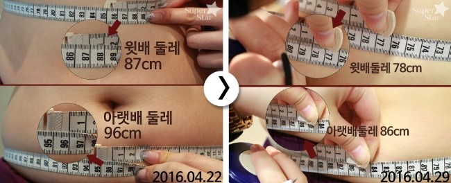 [구로피부과전문의]-비만패키지 첫번째 이야기 관련 이미지 2
