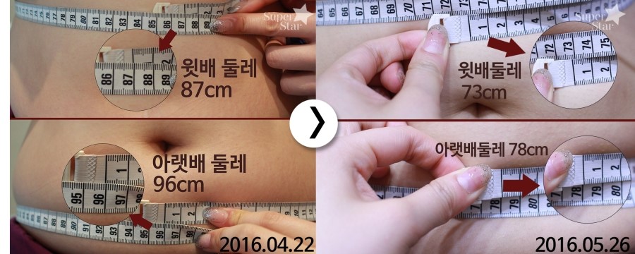 [구로비만클리닉] 비만패키지 최종이야기! 더욱 날씬해진 저희 쌤의 이야기가 듣고싶다면? 고고~ 관련 이미지 1