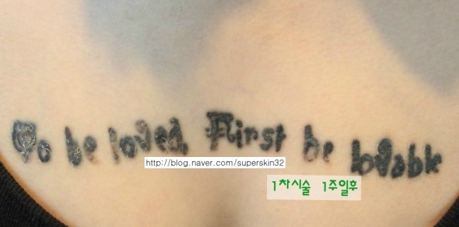 [구로문신제거]슈퍼스타피부과 가슴 문신제거 3차시술 대.공.개~~~ 관련 이미지 1