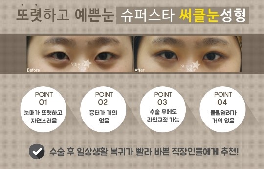 [구로눈성형]구로 눈성형 잘하는 병원!!안성형이사가 직접 수술하는 슈퍼스타피부성형외과! 관련 이미지 2