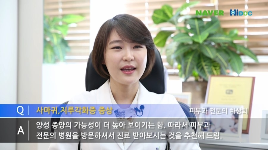 [구로피부과]하이닥 차상희피부과전문의 사마귀?흑색종? 자문인터뷰~ 관련 이미지 2