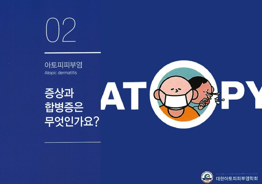 [구로피부과전문의]슈퍼스타피부과에서 알려주는 피부질환 이야기. 아토피 피부염-2 관련 이미지 2