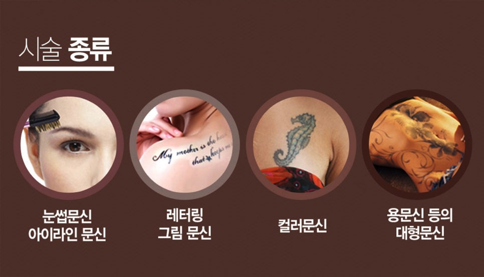 영등포/신도림피부과 문신제거는 피코플러스네요 관련 이미지 7