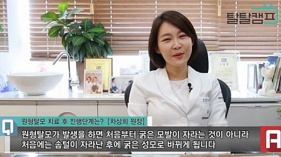 [구로피부과전문의]슈퍼스타피부과 피부과전문의가 제안하는 탈모 TIP~ 탈탈캠프 원형탈모 치료 후 관련 인터뷰! 관련 이미지 2