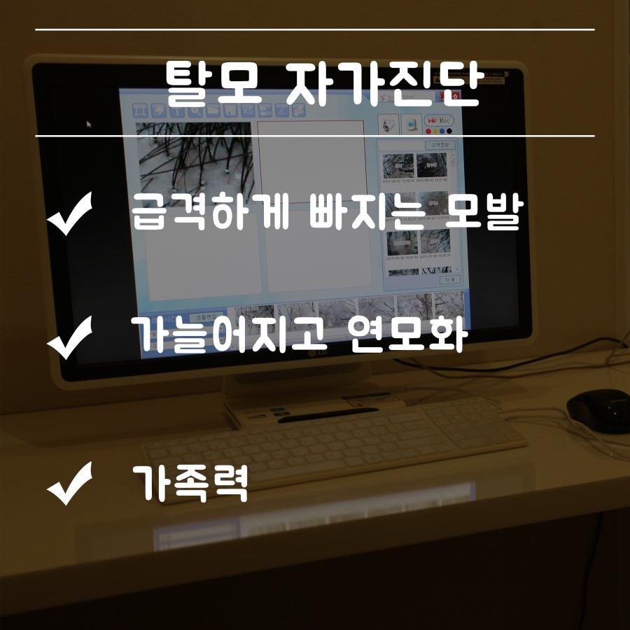 [구로디지털단지피부과]안보고가면 후회하는 경향이 없지않아 있는데 슈퍼스타피부과 탈모 치료~~ + 기적의 모발이식 이벤트 공개! 관련 이미지 3