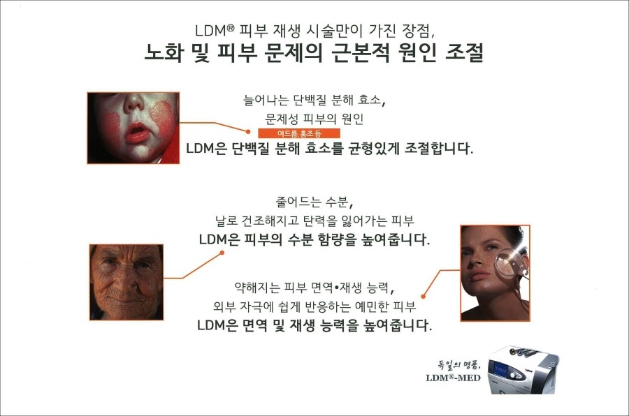 [구로피부과전문의]슈퍼스타피부과에서 알려주는 미용시술 이야기 - 물방울리프팅 [ LDM 리프팅 ] 관련 이미지 5