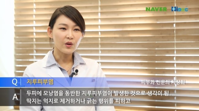 두피에 생긴 지루피부염 관리와 치료법 관련 이미지 2