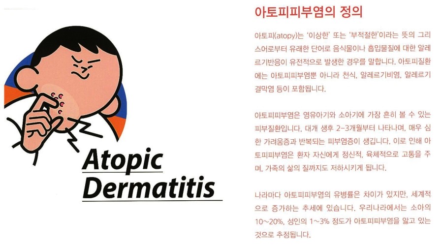 [구로피부과전문의]슈퍼스타피부과에서 알려주는 피부질환 이야기. 아토피 피부염-1 관련 이미지 3