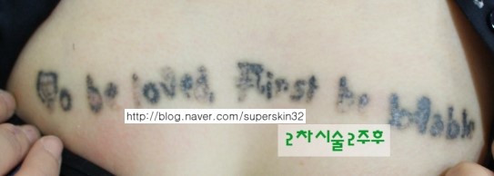 [구로문신제거]슈퍼스타피부과 가슴 문신제거 3차시술 대.공.개~~~ 관련 이미지 2