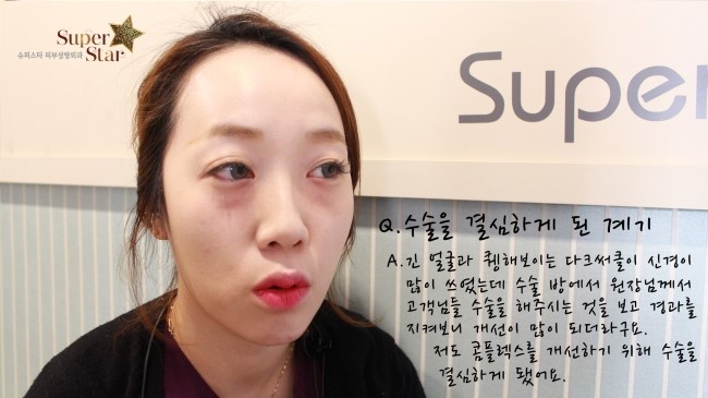 [구로눈성형]슈퍼스타 쏘다미의 동안얼굴 프로젝트~!!제 1편 준비했답니다!! 수술 전 소다미의 심정! 리얼하게 보여드려요~ 관련 이미지 3