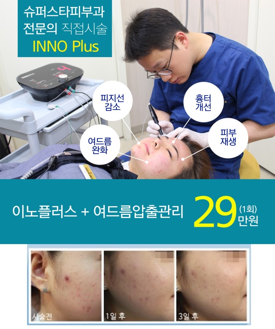 [구로피부과]구로디지털단지 슈퍼스타피부과 9,10월 여드름 이노플러스이벤트 깜짝공개~ 관련 이미지 1