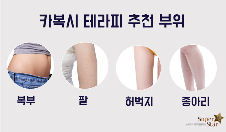 [구로비만]카복시테라피로 봄맞이 제대로 해보자구요~슈퍼스타피부과 카복시테라피 강추! 관련 이미지 4