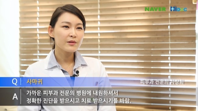 티눈, 사마귀 어떻게 치료해야 할까요? 관련 이미지 6