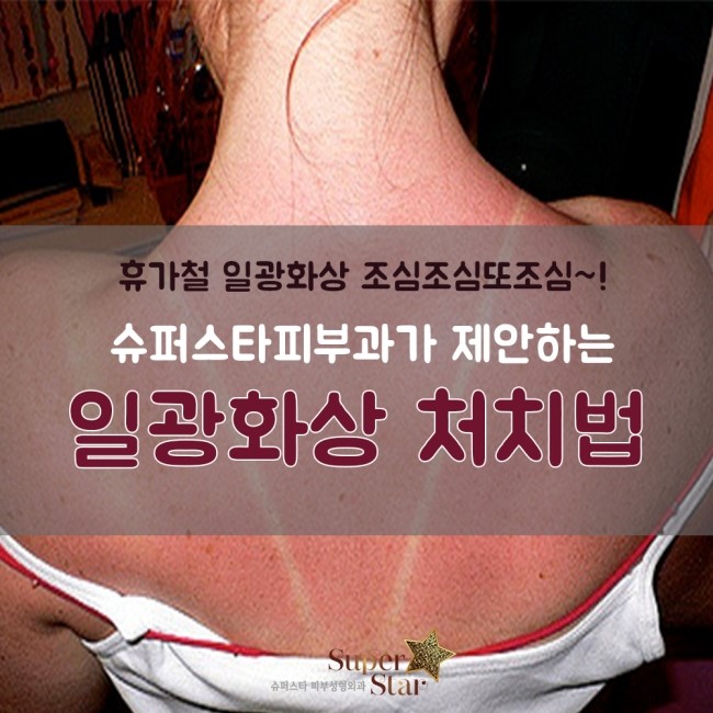 [구로피부과전문의] 슈퍼스타피부과가 알려주는 일광화상 처치방법~! 관련 이미지 1