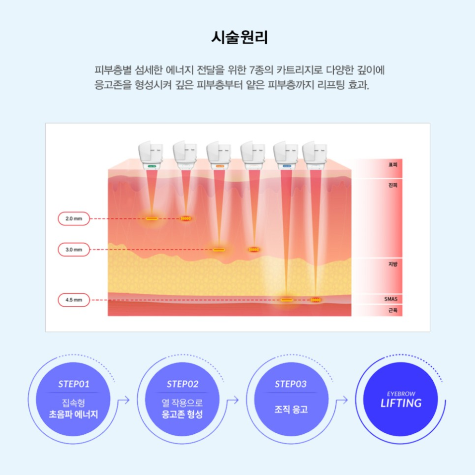 구로디지털단지역 리니어펌 슈퍼스타피부과에서!! 관련 이미지 2