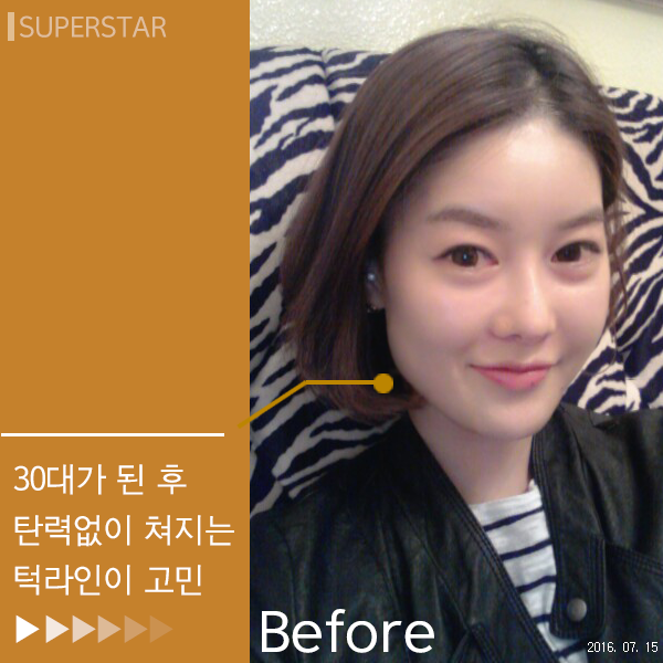 [대림피부과전문의]피부를 UPUP~차세대 초음파 리프팅 울트라포머3 슈.링.크~ 관련 이미지 2