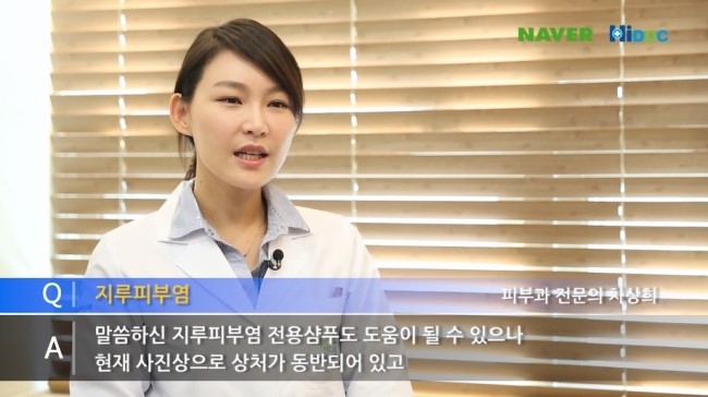 두피에 생긴 지루피부염 관리와 치료법 관련 이미지 5