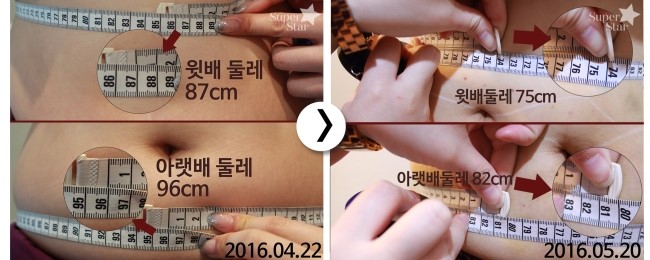 [구로비만클리닉] 비만패키지 마지막 이야기 관련 이미지 2