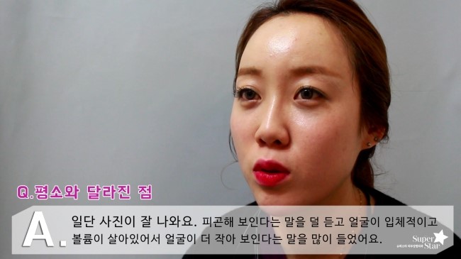 [구로성형]눈밑지방제거+얼굴지방이식=슈퍼리턴즈지방이식! 쏘다미의 수술후 한달! 관련 이미지 3