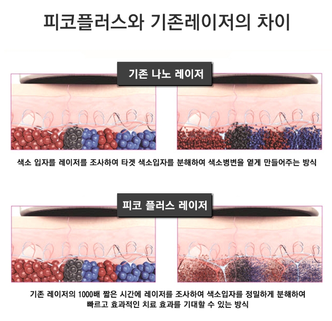 구로디지털단지역피부과 문신제거 2차후 경과 관련 이미지 3