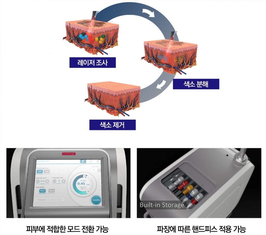 구로디지털단지역피부과 피코플러스로 문신/색소/여드름흉터를 빠르게치료하세요 관련 이미지 6