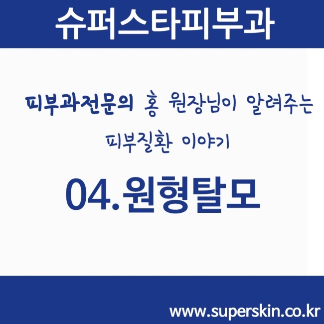 [구로피부과전문의]피부과전문의 Dr.홍원장님이 알려주는 친절한 피부질환 이야기. 04.원형탈모 이야기 관련 이미지 1
