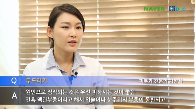 두드러기 원인과 치료방법 알아볼게요!! 관련 이미지 3