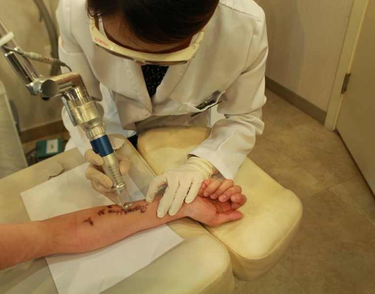 구로디지털단지피부과 문신제거 리얼스토리 관련 이미지 2