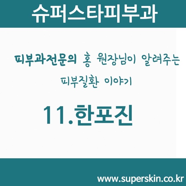 [구로피부과전문의]피부과전문의 Dr.홍원장님이 알려주는 친절한 피부질환 이야기 11.한포진 관련 이미지 1
