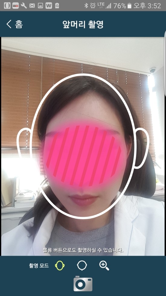 쉽게 탈모를 관리할 수 있는 어플을 소개합니다!! 관련 이미지 5