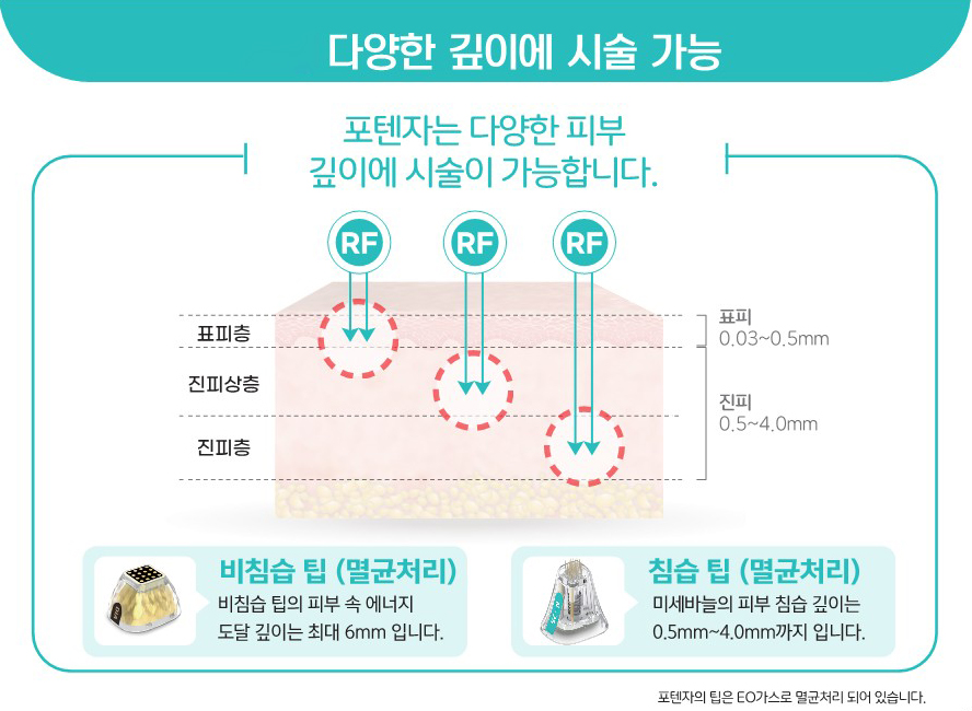 구로디지털단지역피부과 포텐자로 모공 흉터 탄력 리프팅까지! 관련 이미지 7