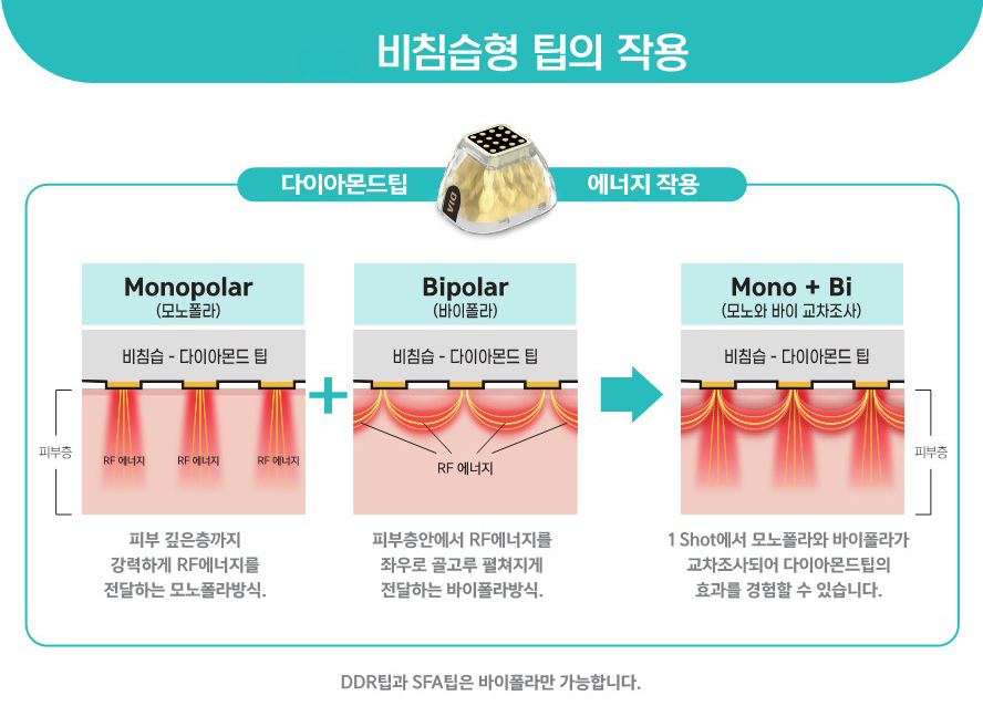 구로디지털단지역피부과 포텐자로 모공 흉터 탄력 리프팅까지! 관련 이미지 5
