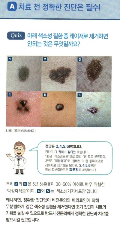 레이저 안전사용! 피부과 전문의를 꼭 확인하세요!! 관련 이미지 2