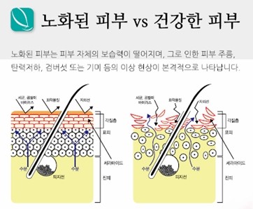 리쥬란 힐러로 젊고 건강한 피부를 회복하세요~ 관련 이미지 3
