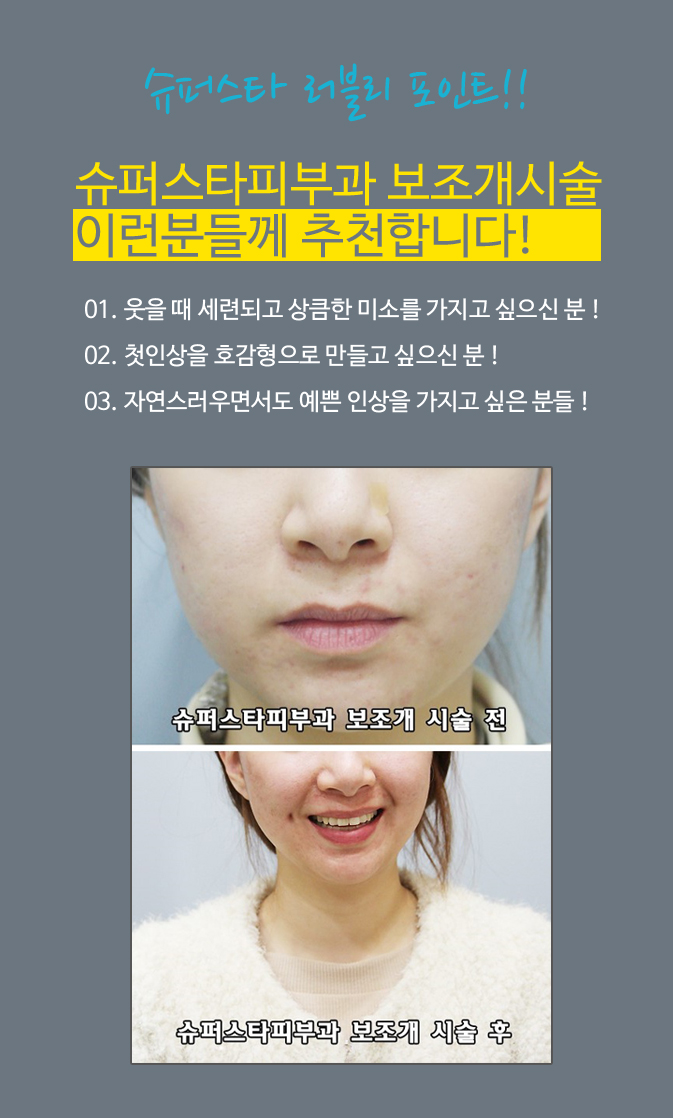 [구로피부과]구로디지털단지 슈퍼스타피부과의 러블리포인트~보조개시술로 예뻐져용~!! 관련 이미지 1